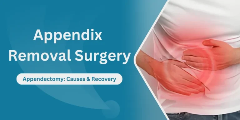 Appendix Removal Surgery
