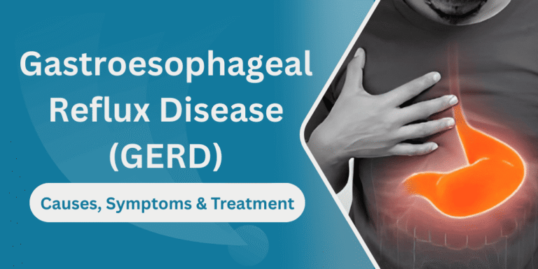 Gastroesophageal Reflux Disease gerd